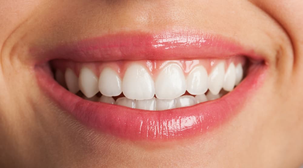 Straighten your teeth without